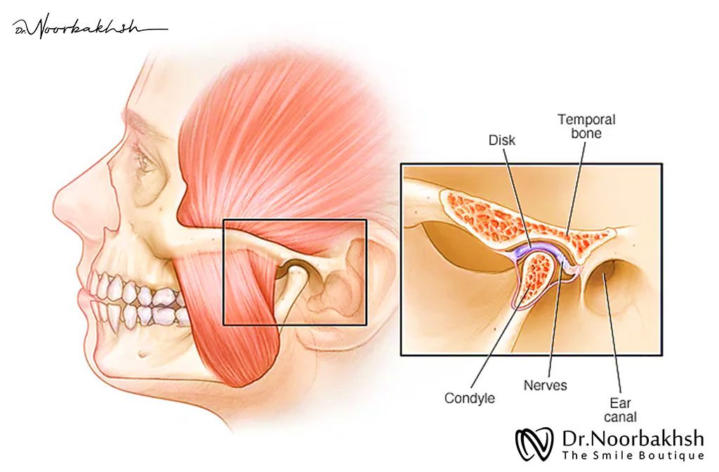 اختلال مفصل گیجگاهی -فکی (TMJ)