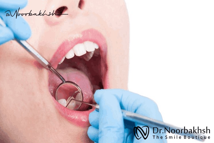 بازسازی یا بیلداپ دندان چیست؟
